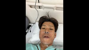 入院費が無いので、瀕死の状態で配信する 金バエ 肝不全末期入院中